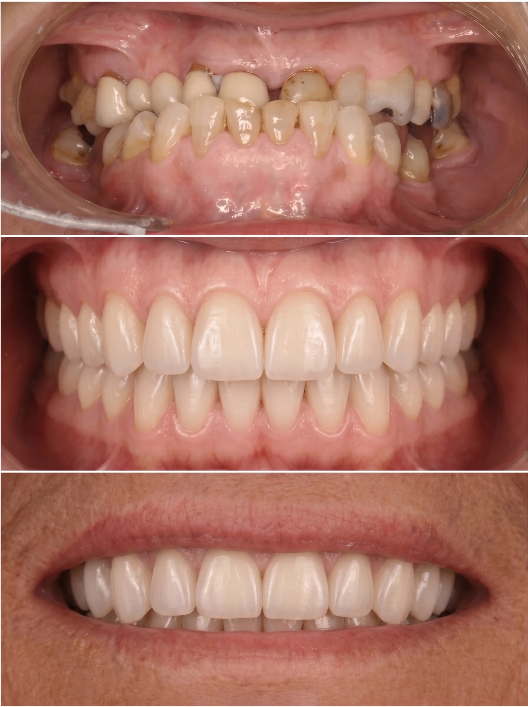 Clínica dental en Zaragoza especializada en rehabilitación oral